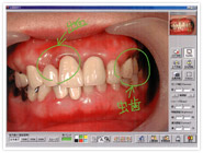 歯科用患者コミュニケーションシステム「ビジュアルMAX」