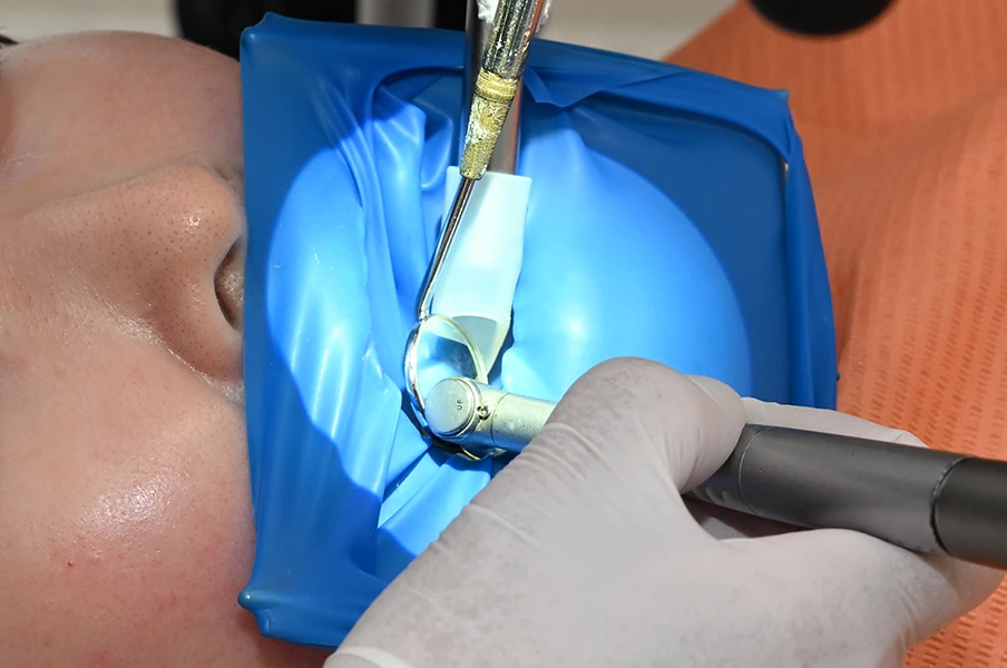 ラバーダムの重要性