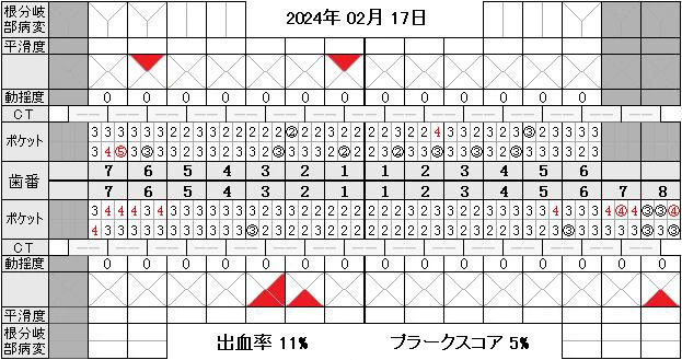 歯周検査