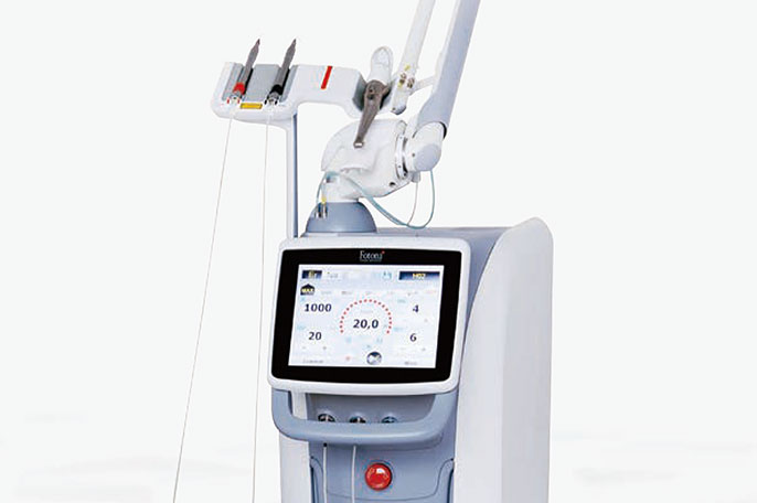 レーザーを使用した虫歯治療